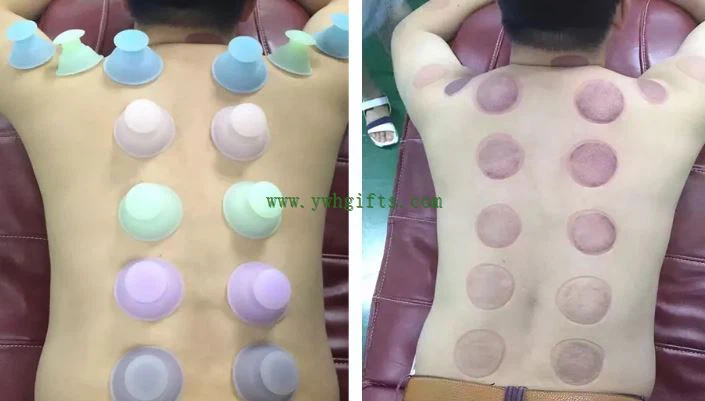 Silicone self-treatment cupping Silicone self-treatment cupping